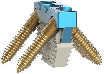 Auxein - PALLAS-Низькопрофільний кейдж для переднього шийного спондилодезу